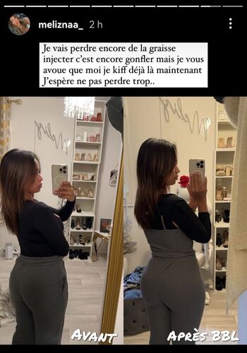 Private Leaked Meliznaa exclusive onlyfans photos 2026