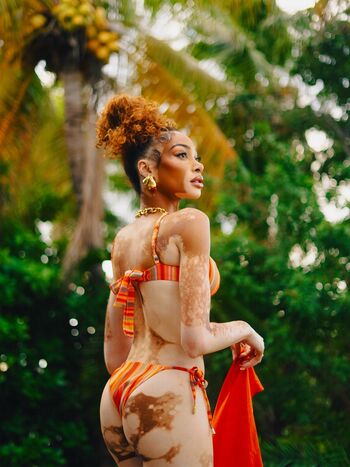 Winnie Harlow