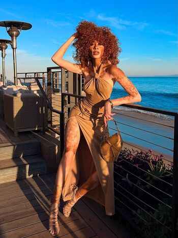 Private Leaked Winnie harlow exclusive onlyfans photos 2026