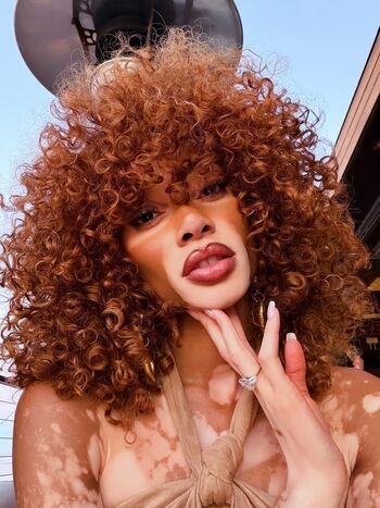 Private Leaked Winnie harlow exclusive onlyfans photos 2026