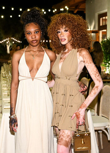 Private Leaked Winnie harlow exclusive onlyfans photos 2026