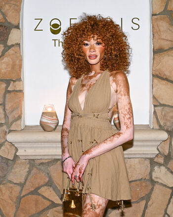 Private Leaked Winnie harlow exclusive onlyfans photos 2026